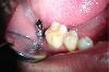 Dhanwanth Dental Care -